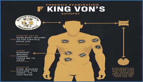 Discover The Shocking Truth: King Von's Autopsy Photos Revealed